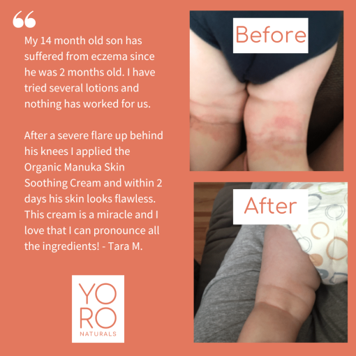 YoRo Naturals Organic Manuka Skin Soothing Cream (59ml) - Image 6