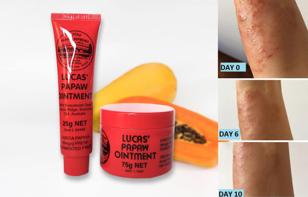 Lucas Papaw Ointment - Now Available - SkinshareSG