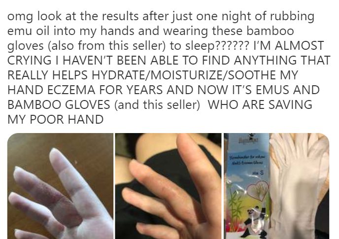 Customer review for YNot-Natural Emu Oil and eczema bamboo gloves