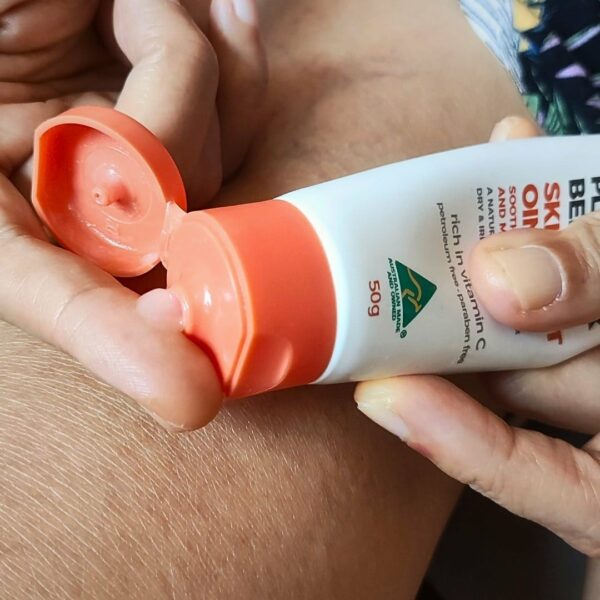 kakadu plum skin ointment for eczema