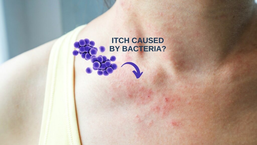 Eczema bacteria