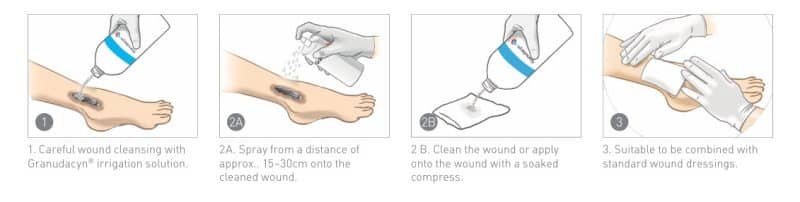 [NEW] Mölnlycke Granudacyn Wound Irrigation Solution (250ml/500ml) - Image 7